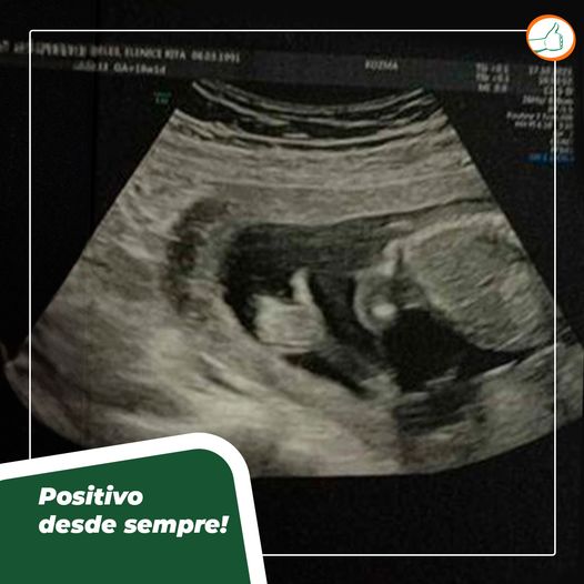 Bêbe aparece em ultrassom fazendo o sinal de positivo
