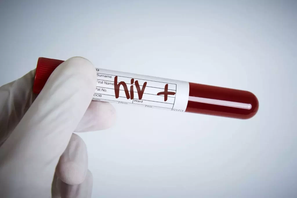 Nova variante do HIV é detectada na Bahia, Rio de Janeiro e Rio Grande do Sul