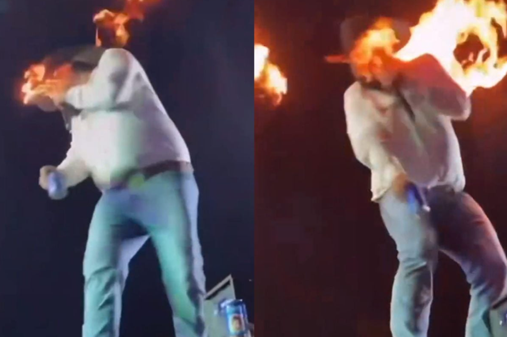 Cantor Léo mostra queimaduras no rosto após fogo no palco