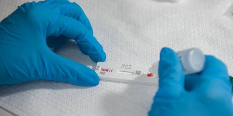 Estudo aponta que 1 a cada 50 pessoas tem HIV na região metropolitana de saúde do RS