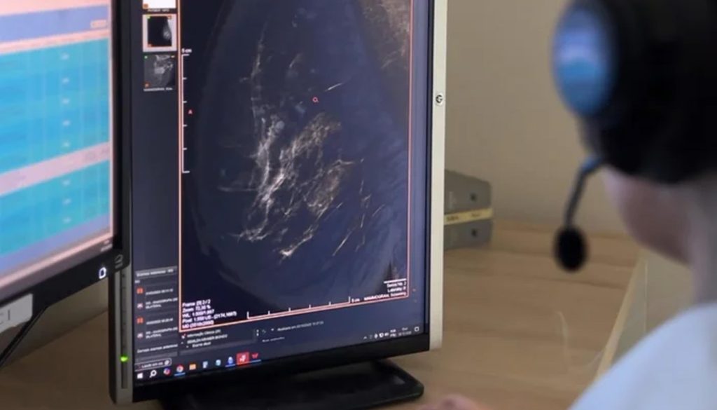 Estado do Rio Grande do Sul registra a terceira maior incidência de câncer de mama no país