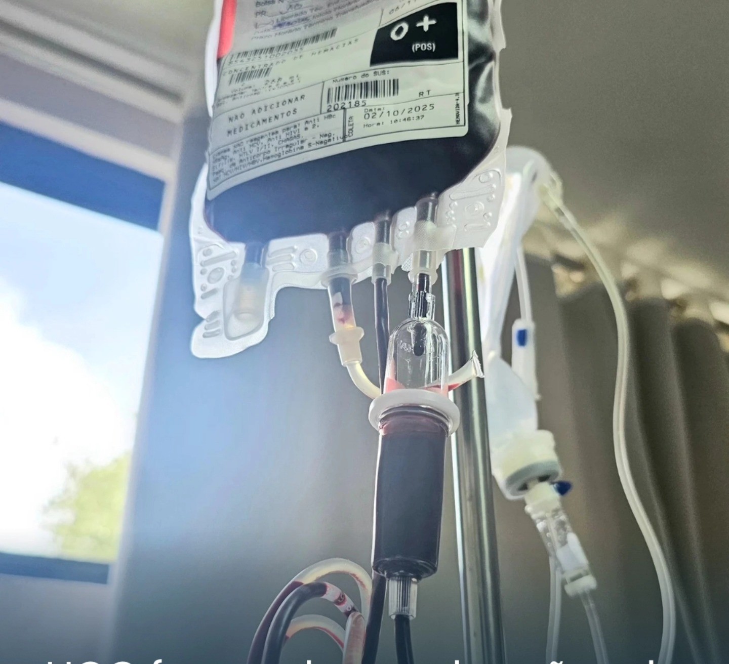 O Hospital de Clínicas de Carazinho faz apelo para doação de sangue