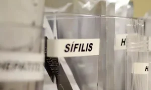 Sífilis continua em ritmo acelerado de crescimento no Brasil