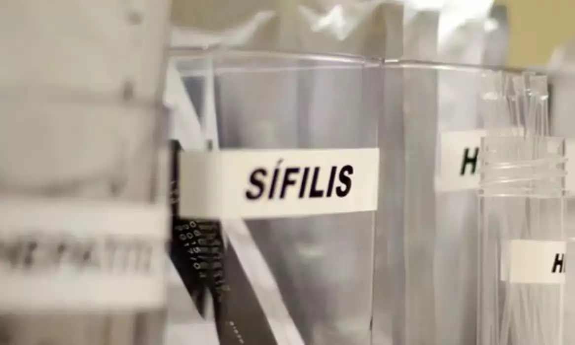 Sífilis continua em ritmo acelerado de crescimento no Brasil