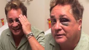 Cantor Leonardo sofre acidente e vai parar no hospital antes de show no Paraná.