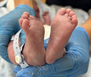 Nascimento marca recorde na Maternidade do HCC e emociona equipe e família