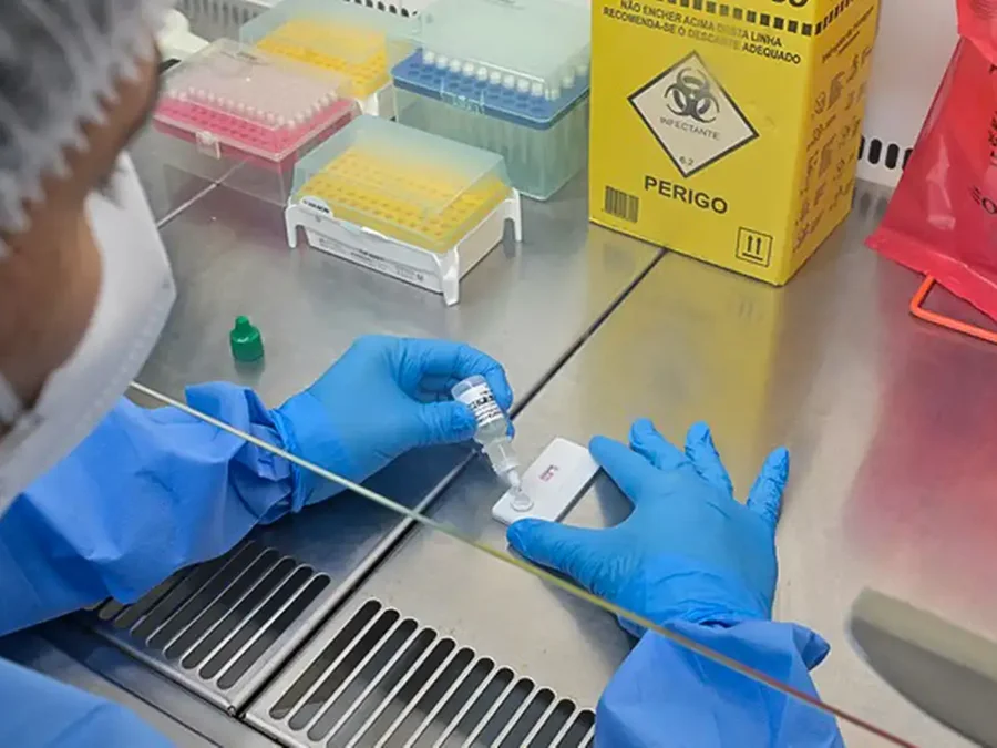 Anvisa atualiza regras sobre controle de qualidade em laboratórios