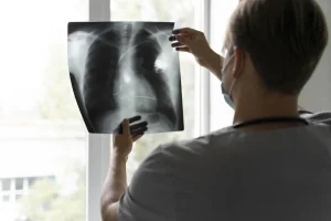 SUS vai oferecer novos medicamentos para tratamento de câncer de pulmão
