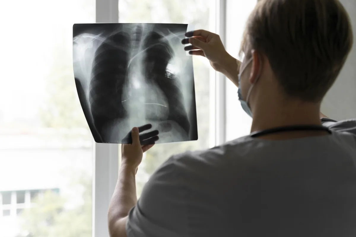SUS vai oferecer novos medicamentos para tratamento de câncer de pulmão